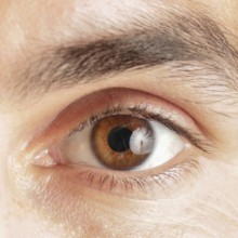 Augen auf Vandalismus sehen